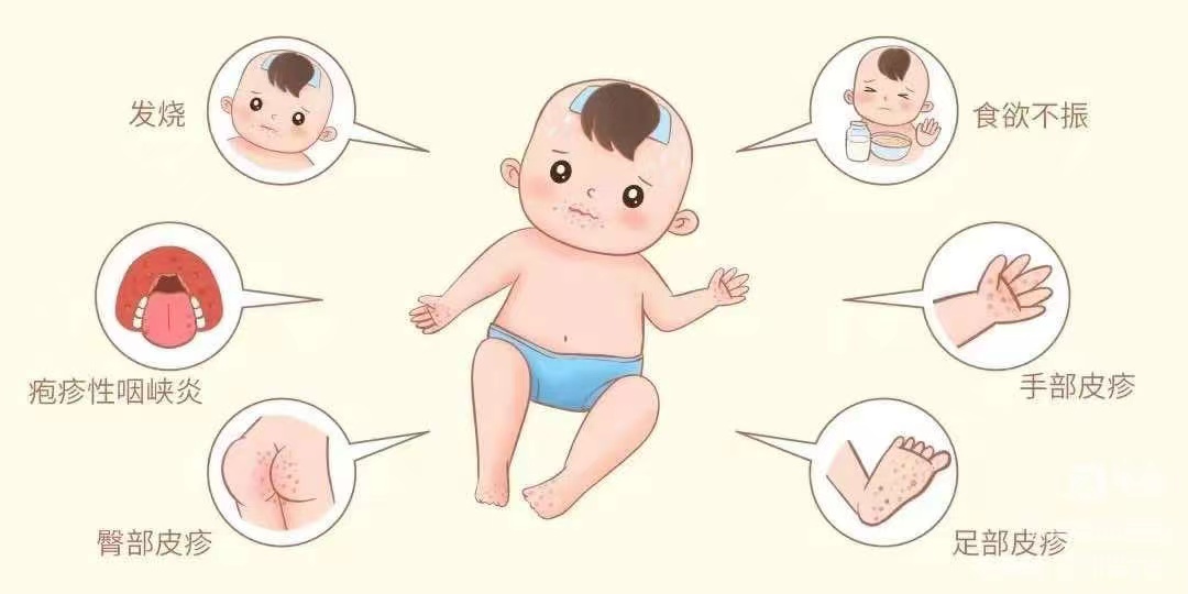 【正学丁三】“预防传染病，健康你我他”——南京市丁家庄第三小学秋冬季预防传染病主题班会 202311171821_html_6ba58a09.jpg