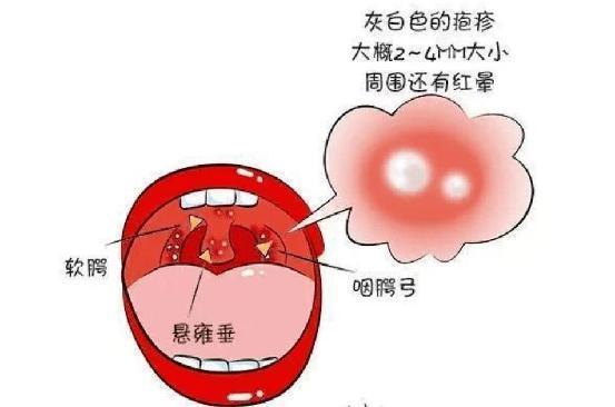 20230519燕幼中心园常见传染病预防_html_m1ac1e8c6.jpg
