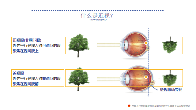 爱眼日校园网文章_html_m7fca340a.png