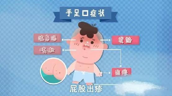 20230519燕幼中心园常见传染病预防_html_m22bf56cd.jpg