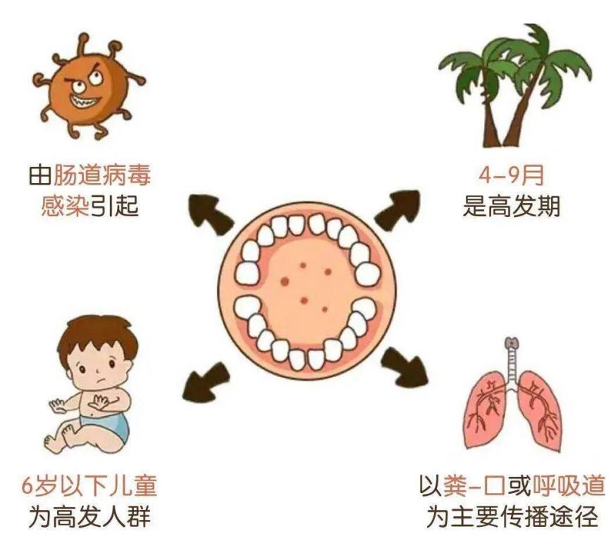 （乐动马幼）【卫生保健】疱疹性咽峡炎与手足口防护方法快收好！