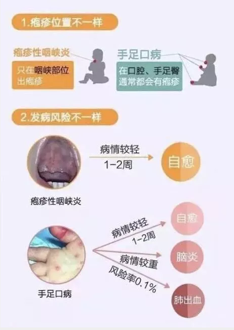 传染病预防知识培训报道_html_2b3e96ad.png