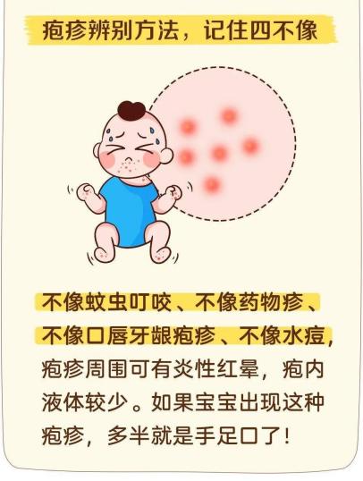 疱疹性咽峡炎_html_m21e2cf85.jpg