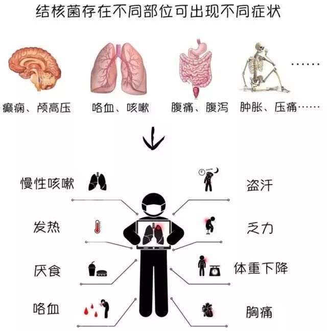 （乐动马幼）【保健知识】结核病的防治
