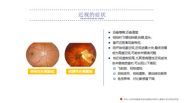 爱眼日校园网文章_html_m51e5a16f.png