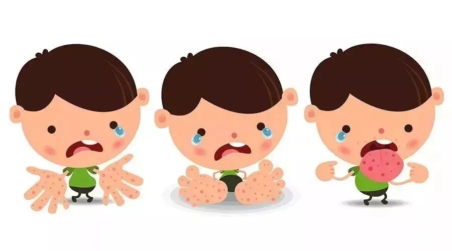 春季常见传染病预防知识_html_m336e13f7.jpg