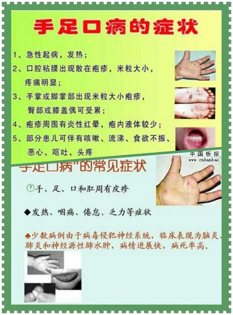 幼儿园手足口病预防知识_html_1ce8af63.jpg
